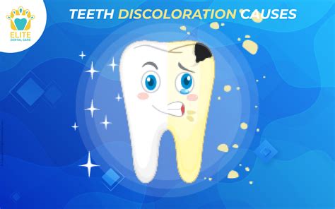 What Are The Causes Of Teeth Discoloration Elite Dental Care