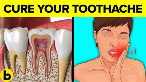 Cure Your Painful Toothaches With These Effective Remedies Youtube