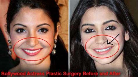 Top Bollywood Actress Before And After Plastic Surgery Youtube
