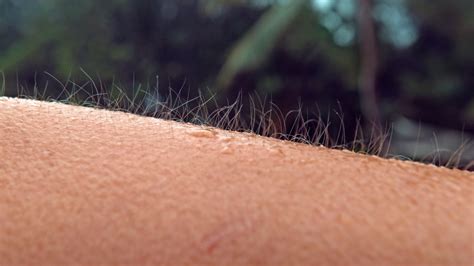 Goosebumps On The Skin Causes Symptoms Treatment And More