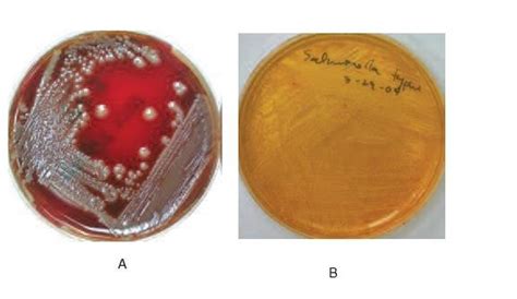 A Escherichia Coli On Sheep Blood Agar B Salmonella Typhi On