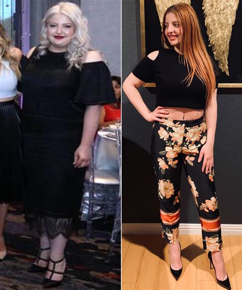 26 Year Old Woman Loses 110 Lbs After Having Gastric Sleeve Surgery And Cutting Sweets