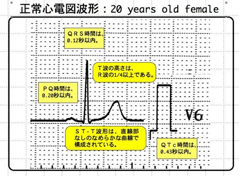 【コラム 003】正常心電図とは？ Cardio2012のecgブログ