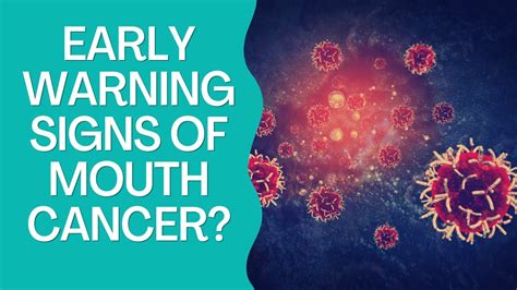 Early Warning Signs Of Mouth Cancer Youtube
