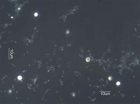 Biofilms In Drinking Water Under The Microscope