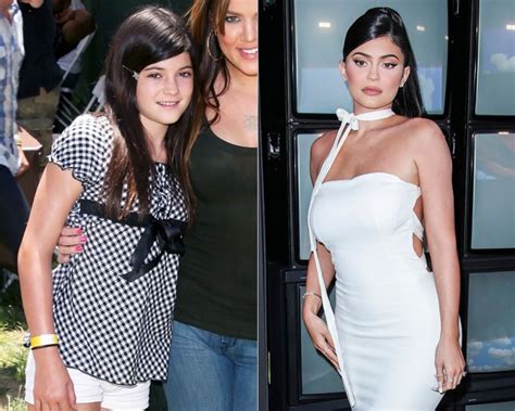 kylie jenner before and after has she had work done — photos hollywood life