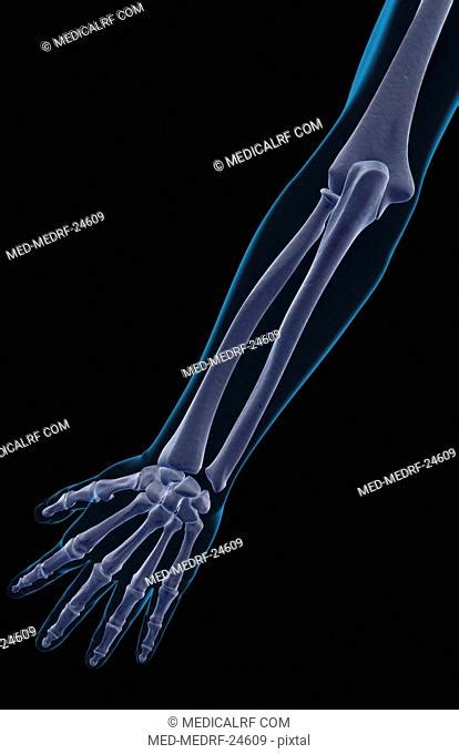 Bones Of The Forearm And The Hand Stock Photos And Images Agefotostock