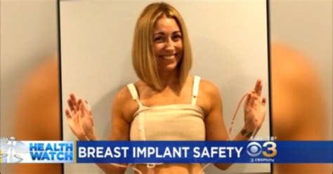 Many Women Getting Breast Implants Removed In Light Of Health Concerns