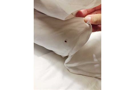Gryzące robaki w łóżku jak je zwalczyć Derato