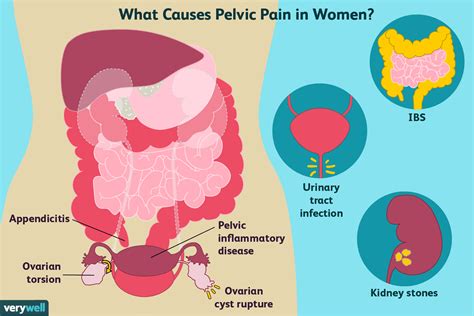 Pelvic Pain Where It’s Located Symptoms Causes And More