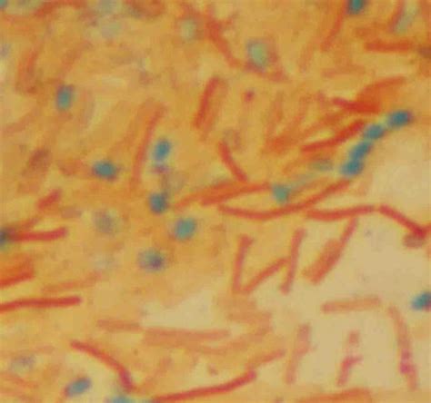 Endospore Bacterial Stain Article Describing Endospore Differential