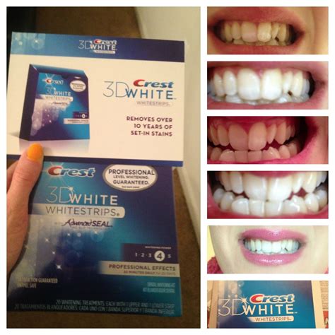 Check spelling or type a new query. Amy Fashion: Crest 3D White Professional Effects Whitestrips