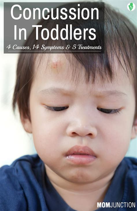 10 Signs Of Concussion In Babies And Ways To Treat It Toddler