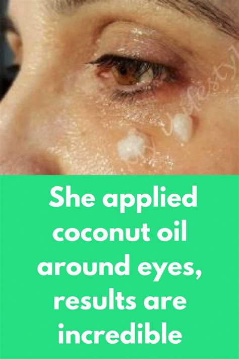 She Applied Coconut Oil Around Eyes Results Are Incredible I Have