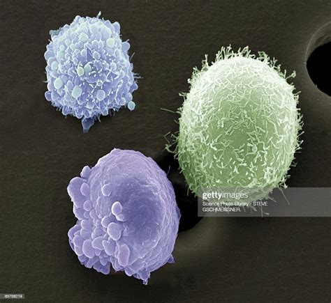 Skin Cancer Cells Scanning Electron Microscope High Res Stock Photo