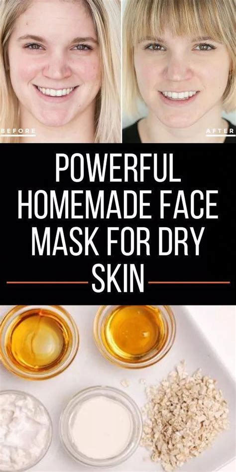 Below Are 3 Very Powerful Homemade Face Mask For Dry Skin That You Can