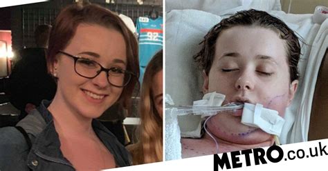 Baker 20 Almost Died Of Sepsis After Dentist Took Her Wisdom Teeth
