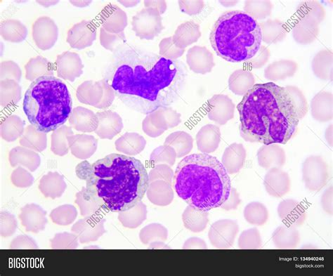 Monocyte Cell White Image And Photo Free Trial Bigstock