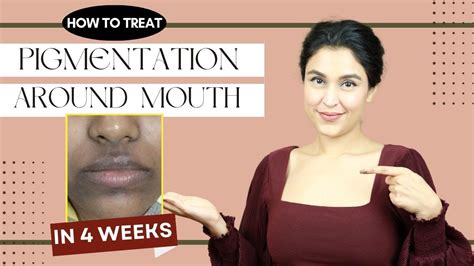 How To Treat Pigmentation Around Mouth Chetali Chadha Youtube