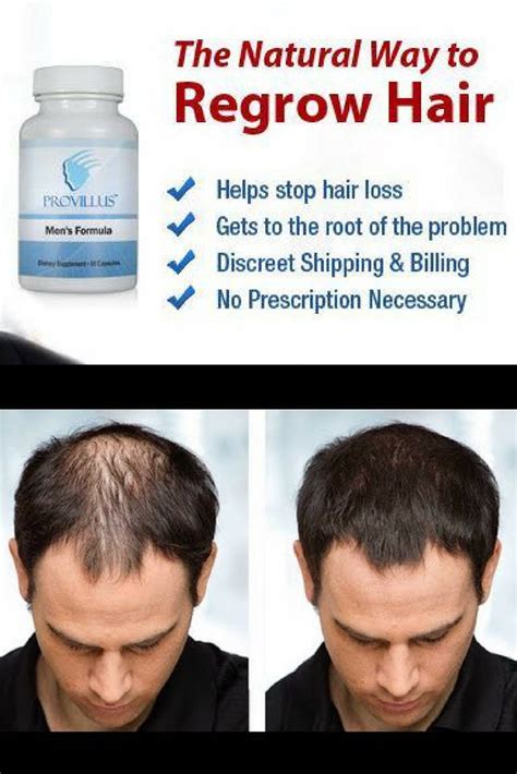 How To Regrow Hair After Baldness A Comprehensive Guide Best Simple Hairstyles For Every Occasion