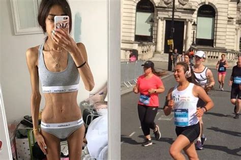 Student S Weight Plunged To Just Stone After Fitness Obsession Led To Anorexia Birmingham Live