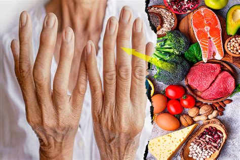 Alimentos Que Ayudan A Tratar La Artritis Y La Artrosis Cosas Femeninas