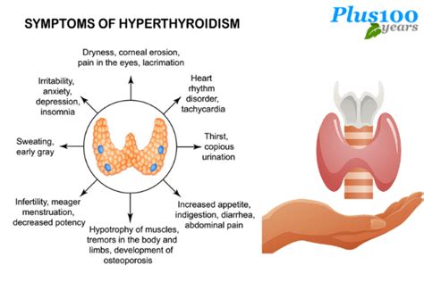 Hyperthyroidism Symptoms Checklist Every One Must Know