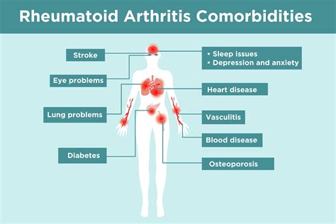 Rheumatoid Arthritis Complications What Ra Patients Need To Know