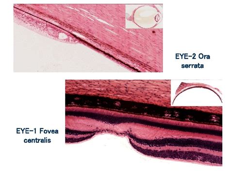 Eye And Ear Histology Orientation Images Eyelid Structures