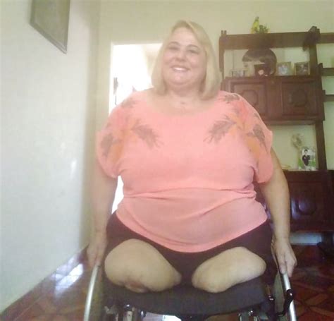 Bbw Amputee Pics My XXX Hot Girl