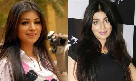 Ayesha Takia Latest Victim Of Plastic Surgery Gone Wrong In Bollywood