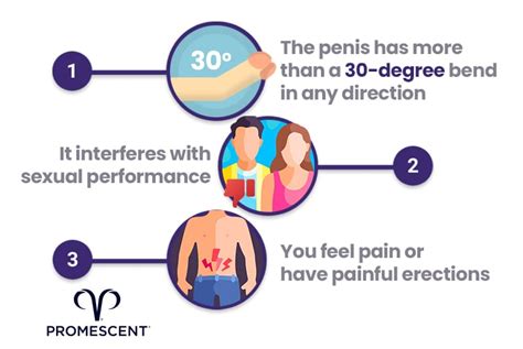 Is Having A Curved Penis Normal And How Much Curve Is Too Much Promescent