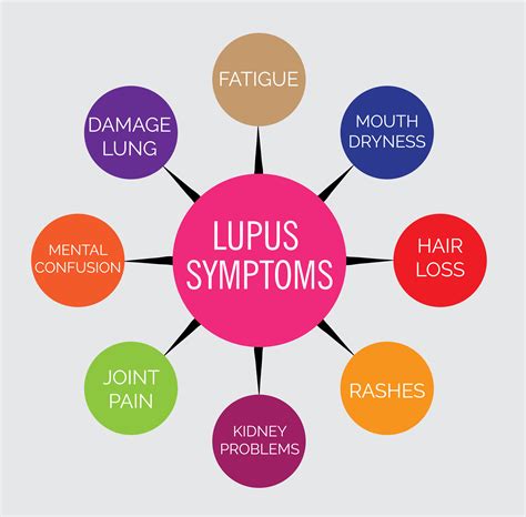 Lupus Diagram Advance Chiropractic And Acupuncture Clinic