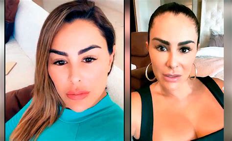 Fotos El Rostro De Ninel Conde Así Empezó El Año Y Así Lo Acabó