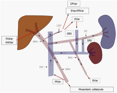 Portosystemic Collateral Pathways And Direction Of Blood Flow In Portal