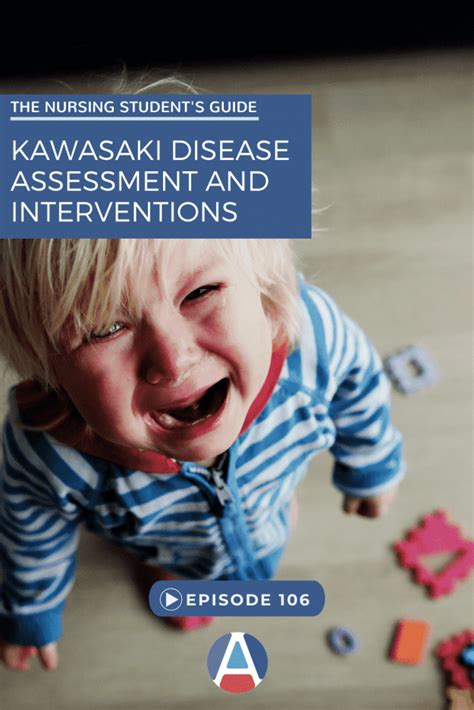 Kawasaki Disease In The Pediatric Patient Straight A Nursing