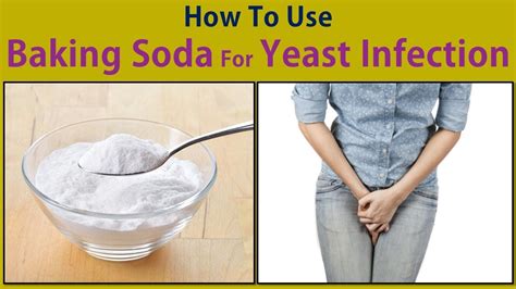 How To Use Baking Soda For Yeast Infection Stop Yeast Infection With