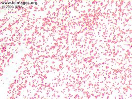 Neisseria Gonorrhoeae Gram Stain