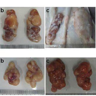 Clinical Pictures Of Inguinal A And Submandibular B Lymph Nodes In