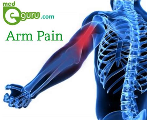 What Causes Arm Pain Pain In Arm Overview By Medegurumed E Guru