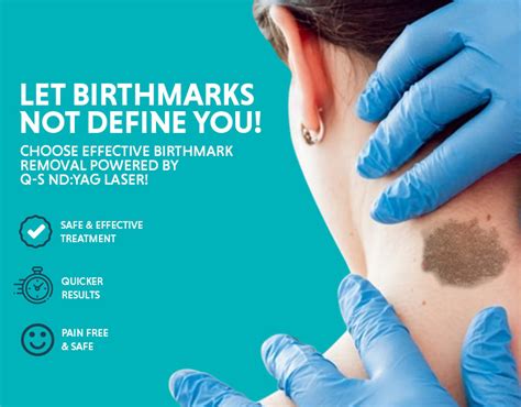 Birthmarks Types Causes And Treatment Options