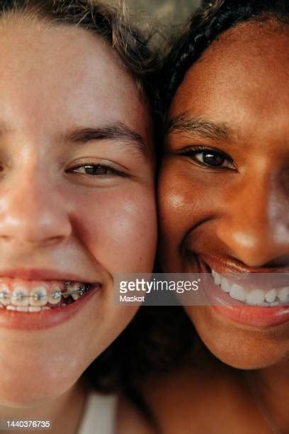 Teenage Girl 14 16 Wearing Braces Smiling Portrait Close Up Photos And