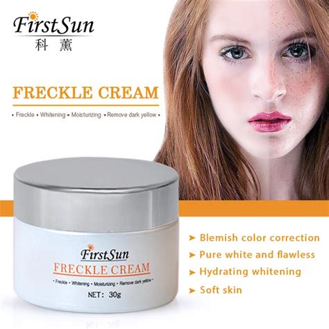 Freckle Removal Cream Day Creams Moisturizers Anti Freckle Whitening Dark Spot Removing Cream