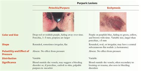 Purpuric Skin Lesions Petechiapurpura And Ecchymosis Grepmed