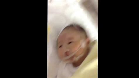 Check spelling or type a new query. 13トリソミー あみちゃん 生後19日目 Trisomy 13 Ami Day 19 - YouTube