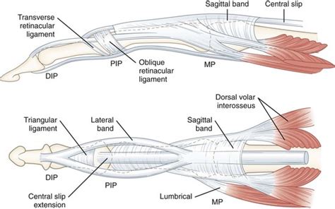 Sagittal Band Injuries—primary And Secondary Management Plastic