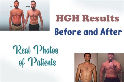 See Hgh Results Before And After Replacement Therapy Hrtus