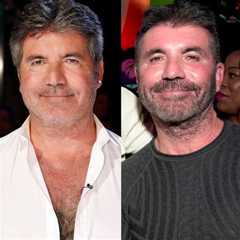 what happened to simon cowell s face did simon cowell have plastic surgery stanford arts review