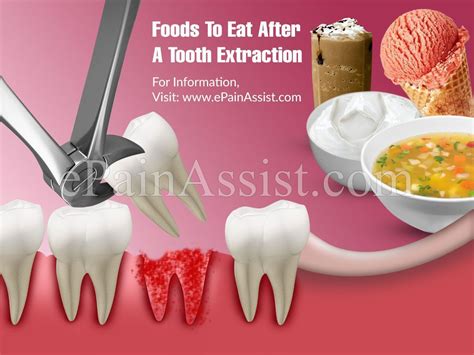 Maybe you would like to learn more about one of these? Foods To Eat After A Tooth Extraction Unhealthy Dental ...