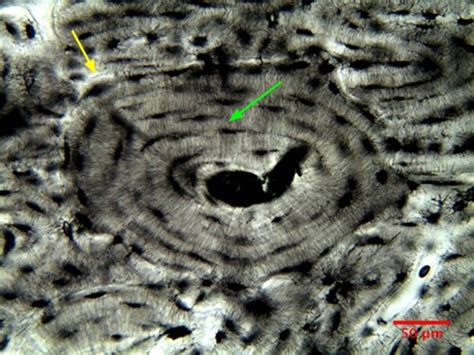 Microscopy of Bone